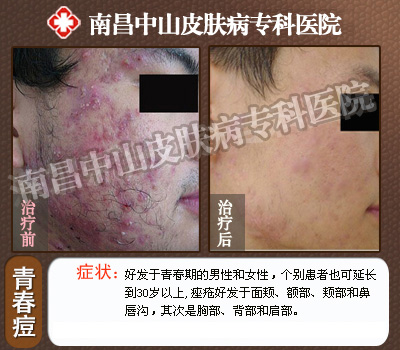 ��Ļ�����ʶ