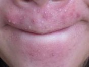 �沿��ľ���ԭ������Щ