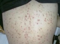 ���ϳ�Ƭ�����ԭ��