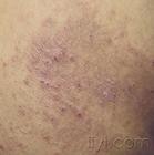 ������������Ƥ��