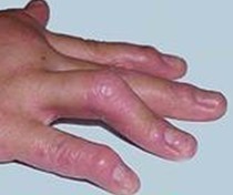 �ؽ�����ţƤѢ�Ĳ�����