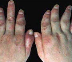 �ؽ���ţƤѢ���ɺ���