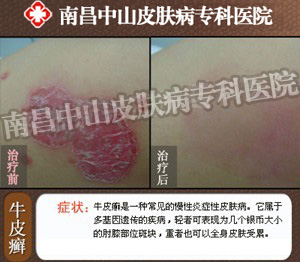 ����ѹ��������ţƤѢ