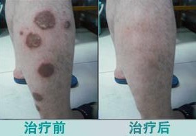 ��ʦ��ţƤѢʧҵ