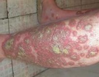 ţƤѢ����Щ֢״����