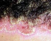 ͷ��ţƤѢ��֢״