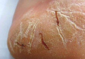 ţƤѢ��������ʲôΣ��