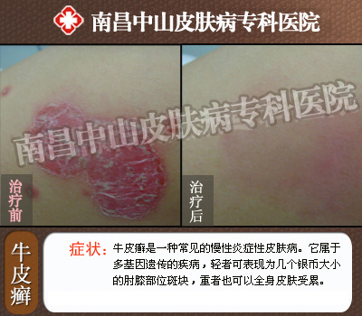 ţƤѢ�ķ������о�