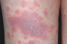 ����Ƥ�׵Ľ�����ʳ