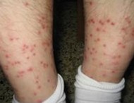 �������չ������ô������