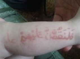 ��ͯţƤѢҪע��ʲô