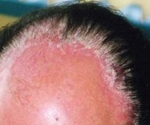 ͷ��ţƤѢ��ô����