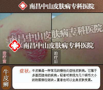 ţƤѢ��ô�ξ�ȥ��ɽƤ����ҽԺ