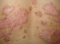 ţƤѢ����ʲô�������