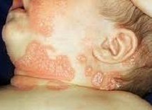 Ϊ��С���ӻỼţƤѢ