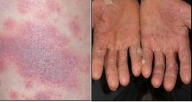 ������Ƥ������Σ�