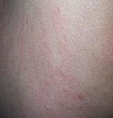 ����Ƥ�׵����Ʒ���