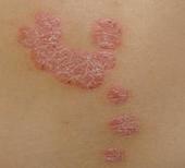 ������Ƥ�����Ƶ�ע����������Щ�أ�