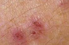 ����Щ�����жϽӴ���Ƥ�ף�