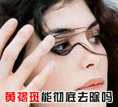 �ƺְ��ܳ���ȥ����