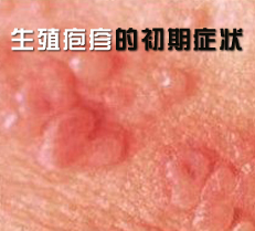 ��ֳ����ĳ���֢״