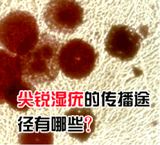 ����ʪ��Ĵ���;������Щ