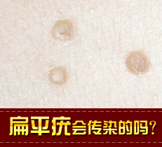 ��ƽ��ᴫȾ����