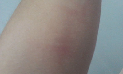 ������������Ƥ�׵Ĳ�����