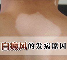 ����ķ���ԭ��