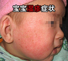 ����ʪ��ͼƬ