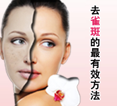 ȥȸ�ߵ�����Ч����