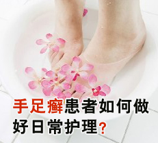 手足癣患者如何做好日常护理