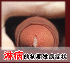 �ܲ�����֢״ͼƬ