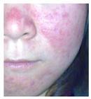 ��ױƷ�Ӵ���Ƥ�������