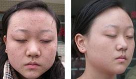 ��ƽ�����ƶԱ�