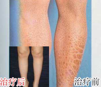 ��ɽƤ����ҽԺ��������16�ꡰ�������