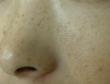 �ƺְߵ���ҽ������ʶ