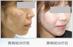 ������ƺְߵ�ȱ��