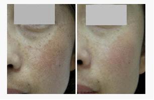 �ƺְ�ר��ҽԺ