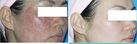 �ƺְ��������