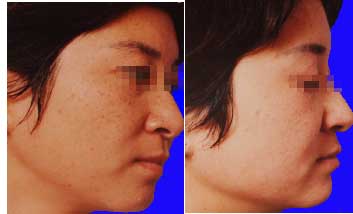 �ƺְ����ȥ��