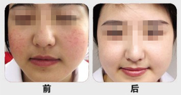 �ƺְ�������