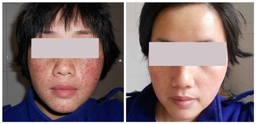 �ƺְ��������