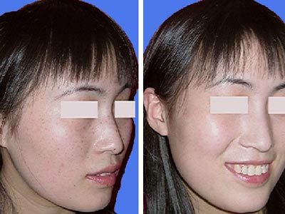 �ƺְ�����