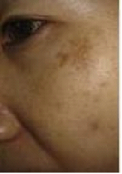 �ƺְߵı���