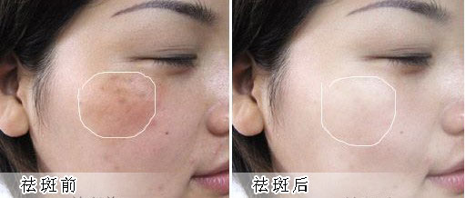 �ƺְ߿�����