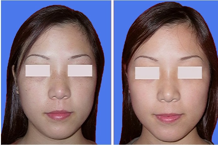 �ƺְߵ����Ʒ���