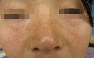 Ƥ����ɫ�仯