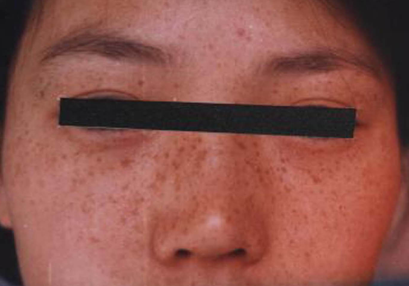 �������ǻƺְ�