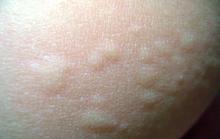 �����ЧԤ��ݡ���